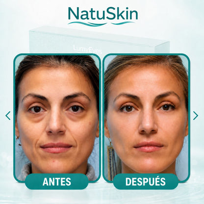 NatuSkin | Parches de Colágeno para Ojeras y Mirada con Aspecto Cansado